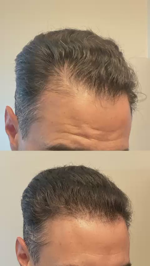 Hair Thickening and Revitalizing Bio-Cleansing Shampoo and Thickening Conditioner Set