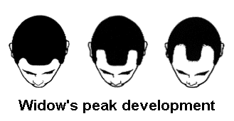 WIDOW’S PEAK VS MATURE HAIRLINE