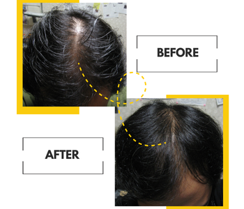 2-Pack: Hair Thickening and Revitalizing Bio-Cleansing Shampoo