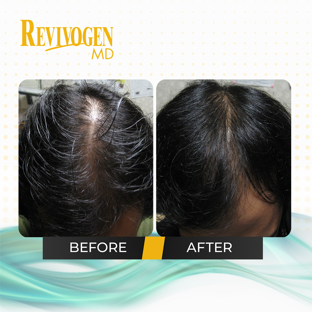 2-Pack: Hair Thickening and Revitalizing Bio-Cleansing Shampoo