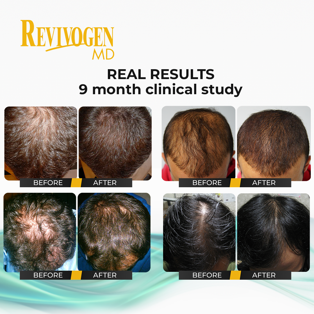 2-Pack: Hair Thickening and Revitalizing Bio-Cleansing Shampoo