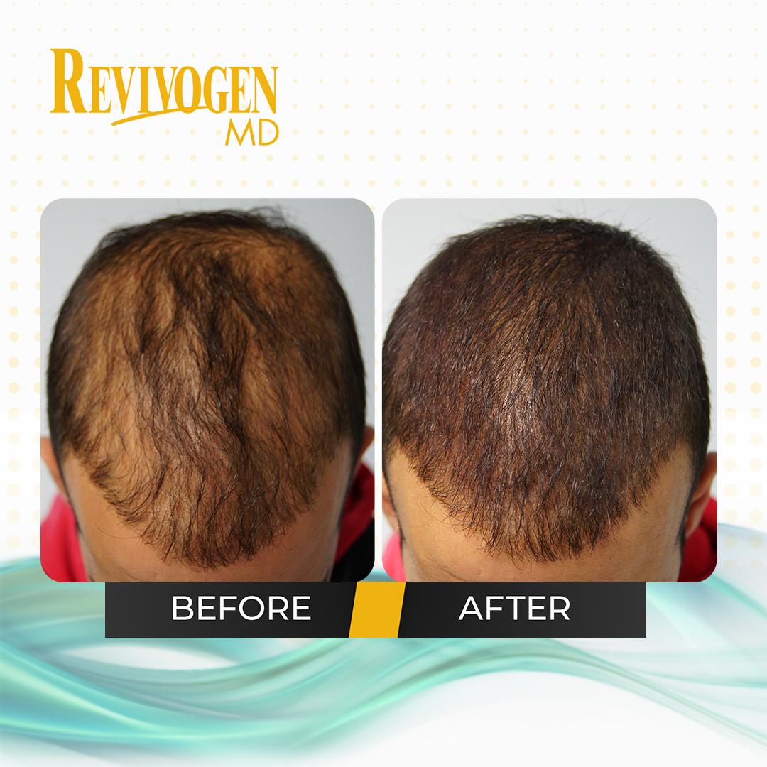 Acondicionador espesante