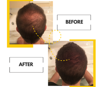2-Pack: Hair Thickening and Revitalizing Bio-Cleansing Shampoo