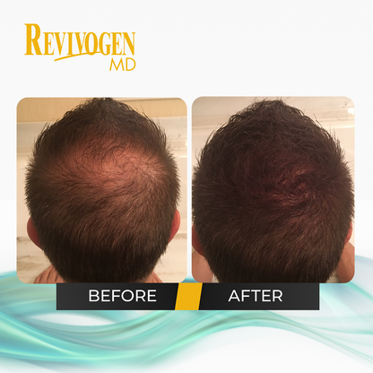 2-Pack: Hair Thickening and Revitalizing Bio-Cleansing Shampoo