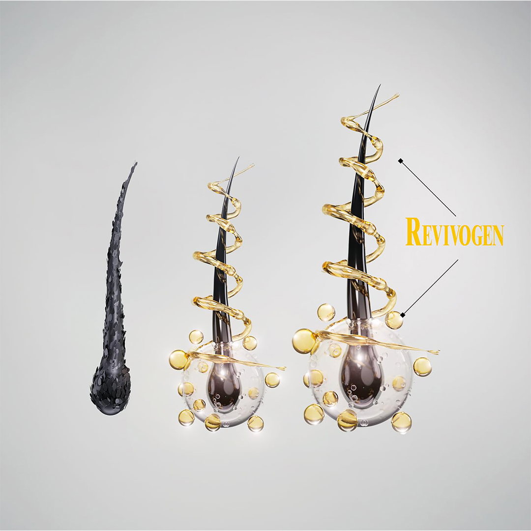 Kit de terapia capilar para el cuero cabelludo de 90 días