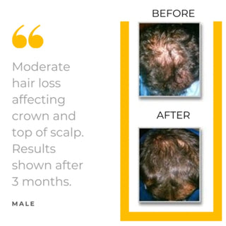 MD Bio-Cleansing Shampoo