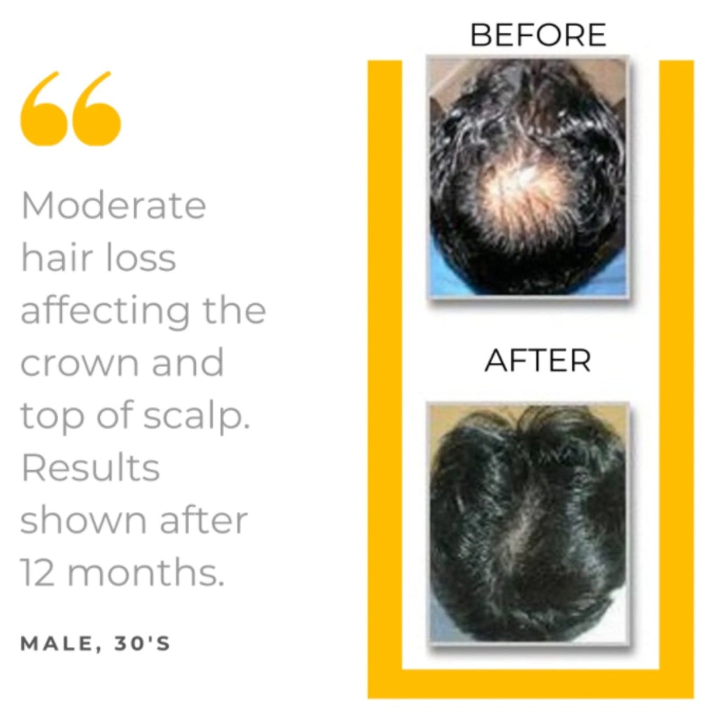 MD Bio-Cleansing Shampoo