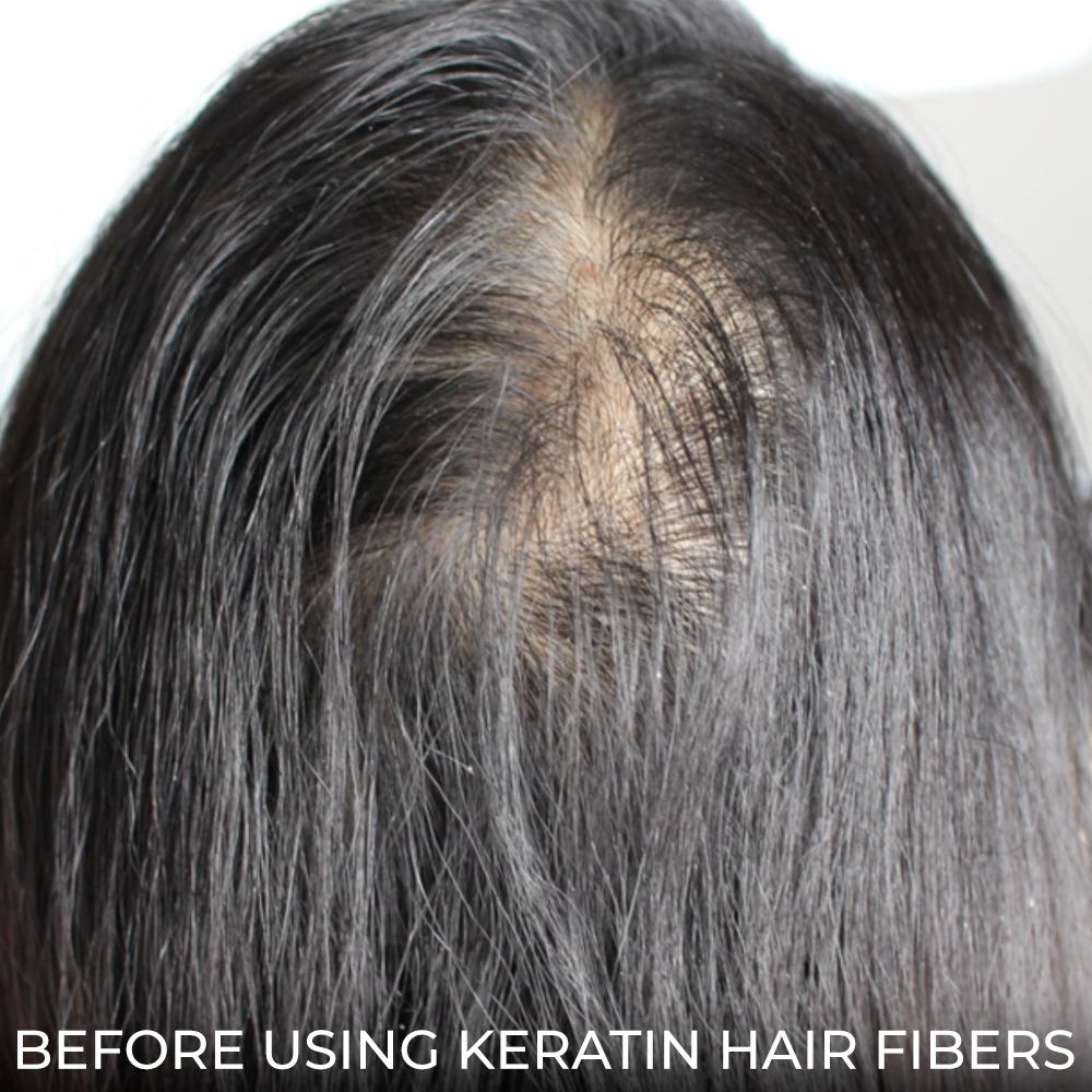 MD Keratin Hair Fibers