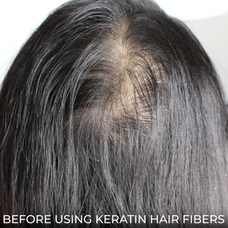 Women's Hair Growth Transition Kit: PRO Bio Cleansing Shampoo & Keratin Hair Fibers