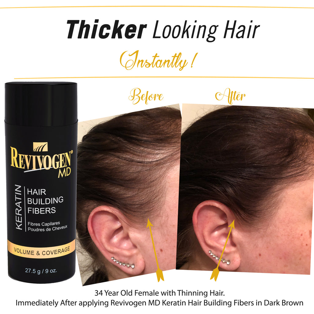 NEW! Hair Loss Defense 6-Piece Transition Starter Kit - 90 Day Supply