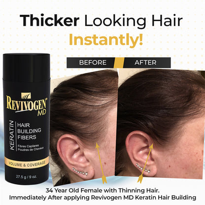 ¡NUEVO! Kit de transición de 6 piezas para la protección contra la caída del cabello (suministro para 90 días)