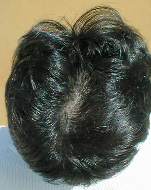 After image
