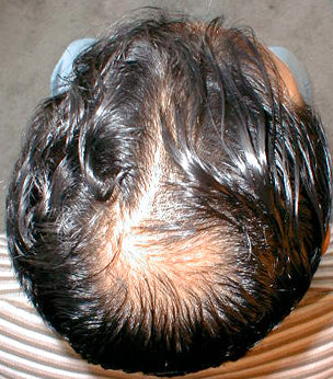 Before image