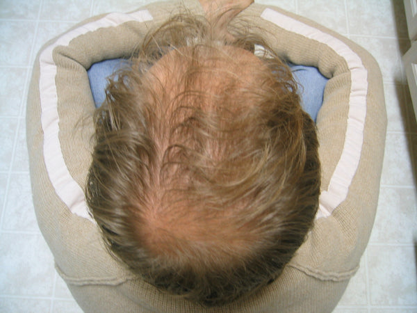 Before image