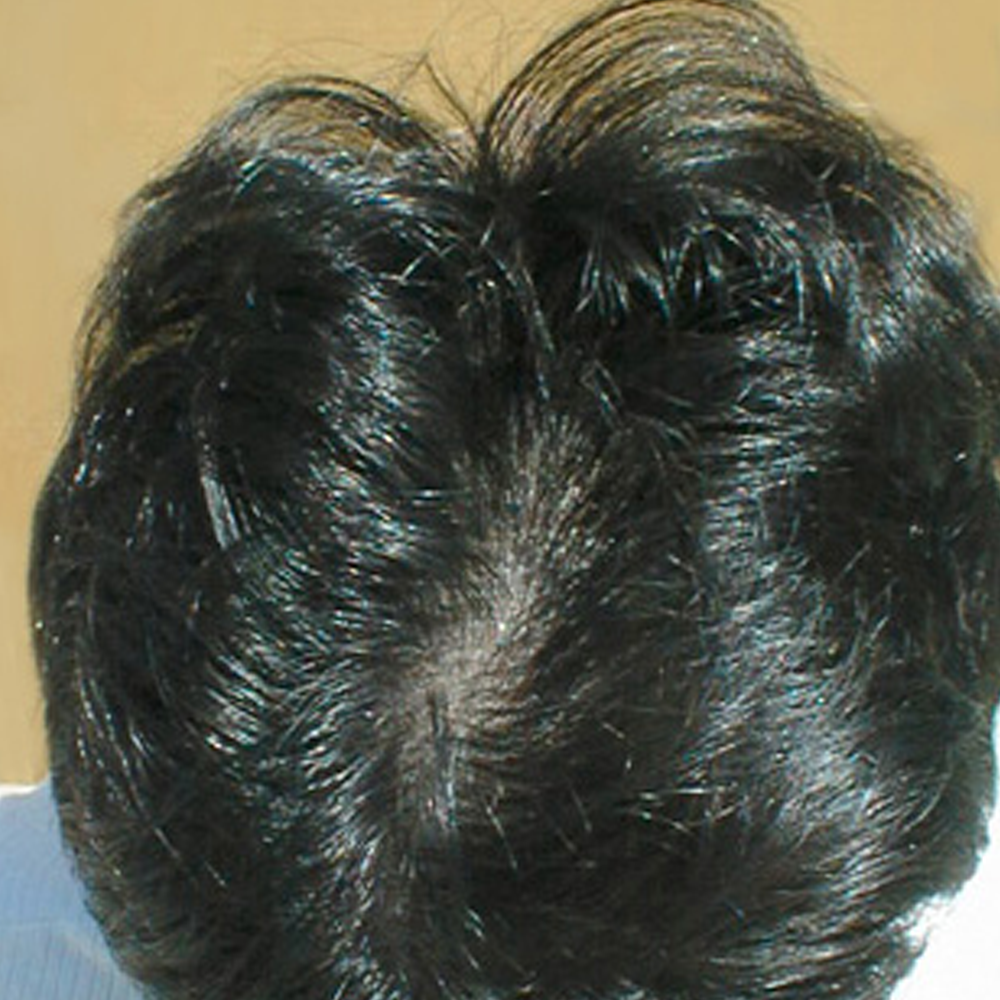 Acondicionador espesante